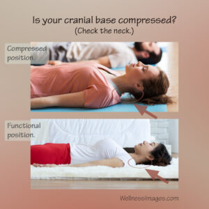Compare cranial base compression with functional resting head position.